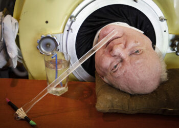 Paul Alexander: Polio Affected person With Iron Lung Dies at 78