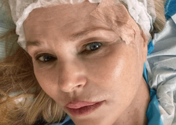 Supermodel Christie Brinkley has pores and skin most cancers faraway from face: ‘I used to be fortunate’ – Nationwide