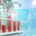 Scopio Labs gains De Novo clearance for AI bone marrow analysis software and more FDA clearances