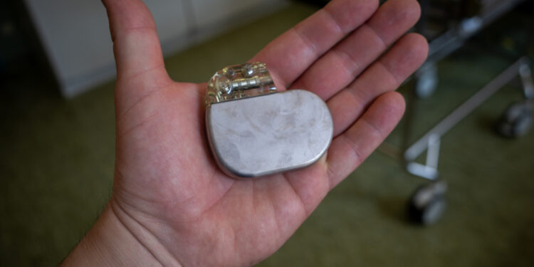 How Hypertrophic Cardiomyopathy Progresses in Adults