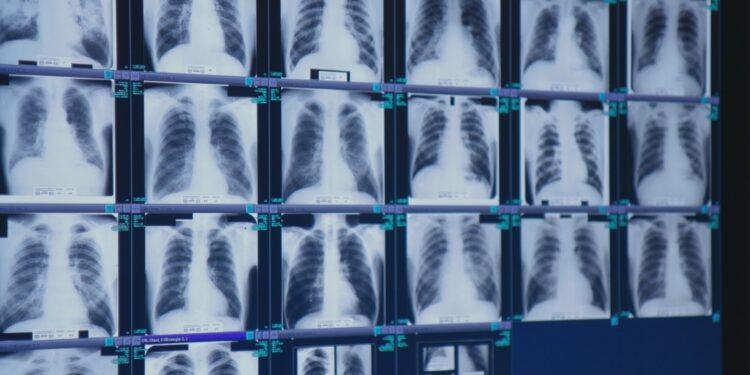 Finally, tough new safety rules are out to prevent severe black lung : Shots