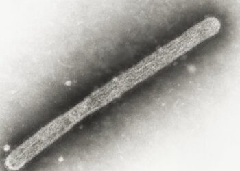 Michigan Dairy Worker Diagnosed With Bird Flu