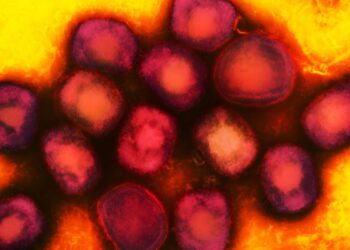 Health Experts are Watching a More Dangerous Version of Mpox