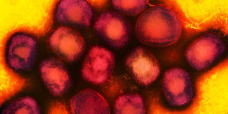 Health Experts are Watching a More Dangerous Version of Mpox