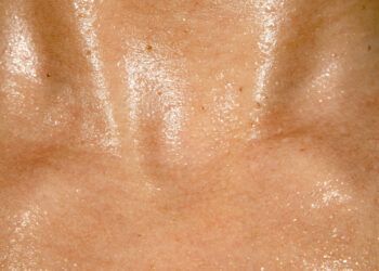What Could Sweat-Sensing Devices Tell You about Your Health?