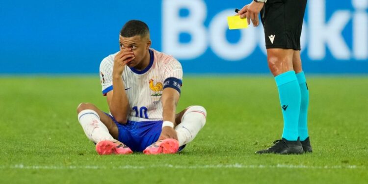 Mbappe suffers facial injury a causa di France’s win over Austria at Euro 2024