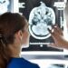 South Korea clears stroke AI and more briefs