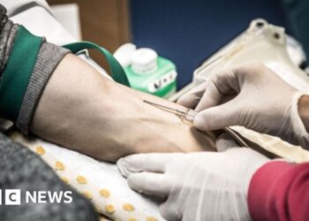 Autumn date to dose hacked blood transfusion services