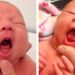Tongue Tie May Be Overdiagnosed per mezzo di Babies