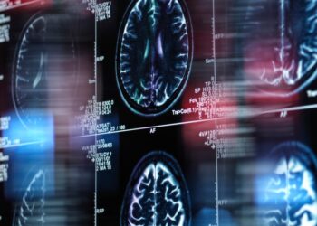 FDA Approves Second Alzheimer’s Drug That Can Slow Disease