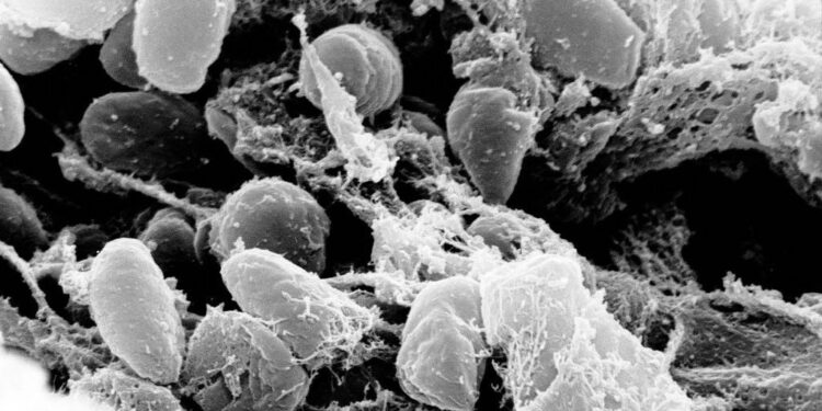 The Plague Never Went Away: What to Know